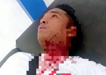 Padahal Jualannya Belum Habis, Seorang Pedagang Bakso Keliling Diduga Dibacok Preman di SidimpuanJumat, 18 Jul 2025 – 14:27