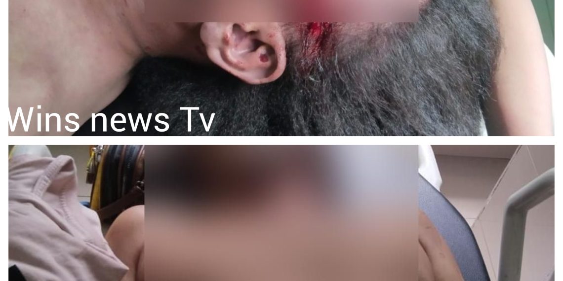 Jurnalis Ditemukan Tewas dengan Luka di Sekujur Tubuh, Polisi Selidiki Dugaan Pembunuhan