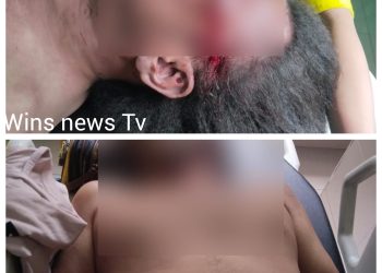 Jurnalis Ditemukan Tewas dengan Luka di Sekujur Tubuh, Polisi Selidiki Dugaan Pembunuhan