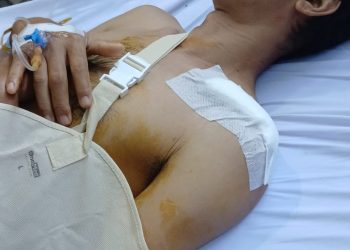 Setahun Lebih Perkara Lakalantas Tak Kunjung Tuntas, Kanit Lantas Akui Masih Koordinasi dengan Kasat Lantas Polrestabes Medan