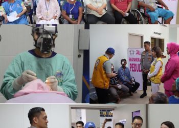 Wujudkan Kepedulian Nyata, Polres Binjai Bersama Bhayangkari Gelar Bakti Kesehatan Operasi Katarak